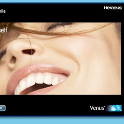 Venus Virtual Smile